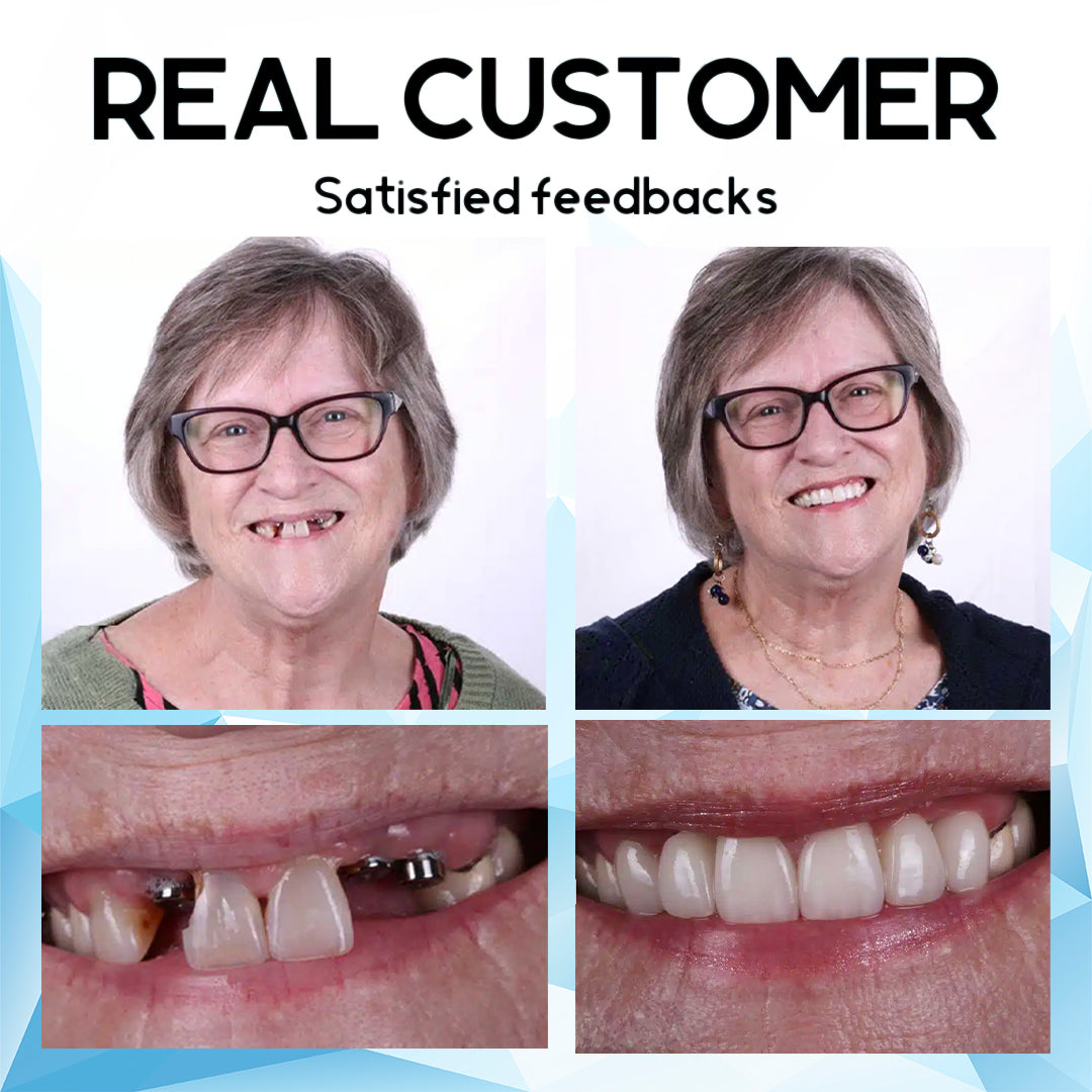 HERMSA™Silicone Reline Denture Set (👩🔬Dentist Recommendations👩🔬)