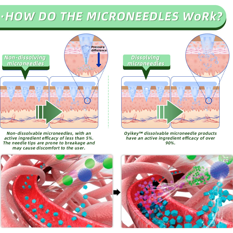 👩⚕️Honxi™ SMGT-GLP-1 Nano Microneedle Patch(Painless, long-lasting, addressing diabetes, obesity, and cardiovascular diseases)