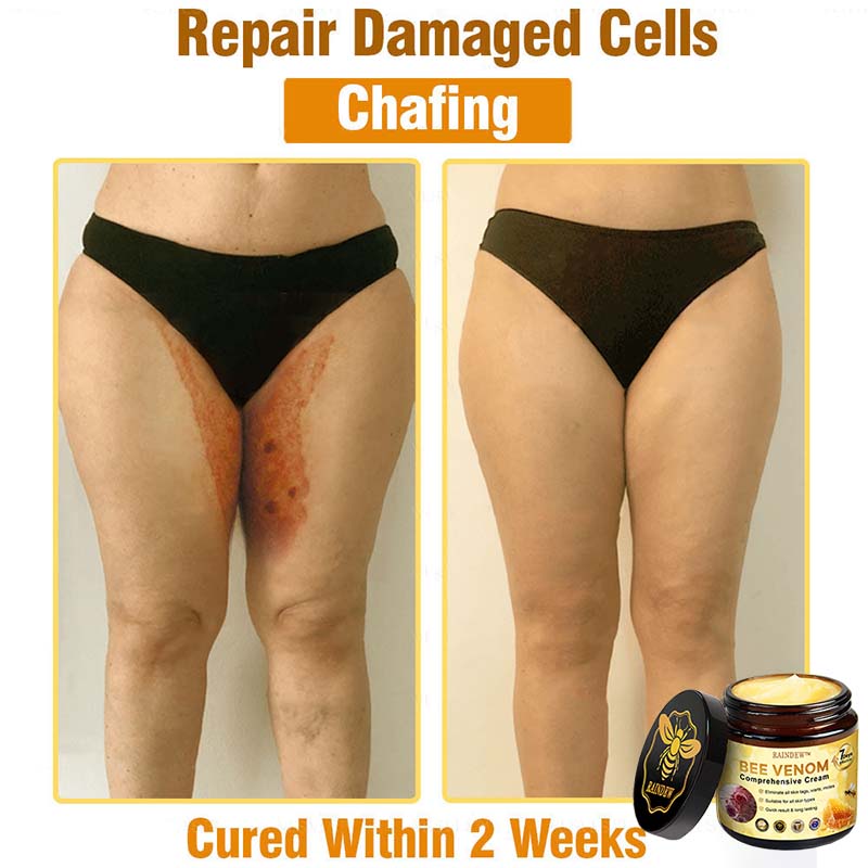 Raindew™ Bee Venom Comprehensive Cream (Suitable for all ages & TGA recommends)
