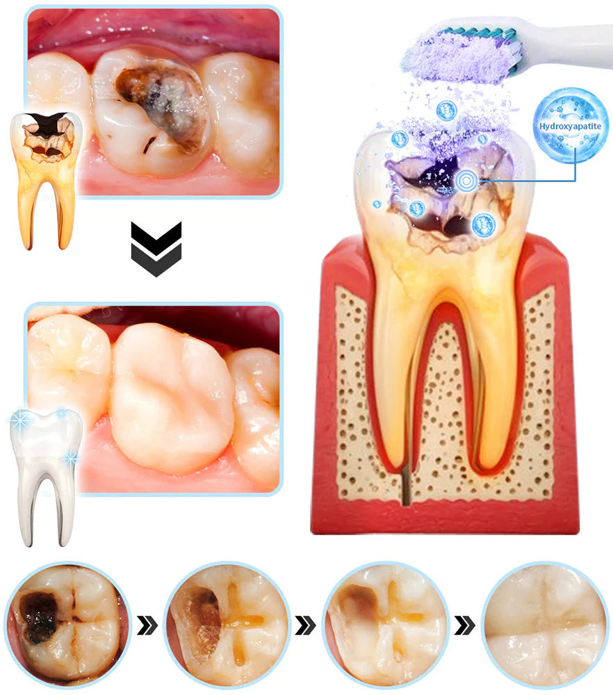 Honxi™ (BDA recommended)TeethRestoration Mineral Powder