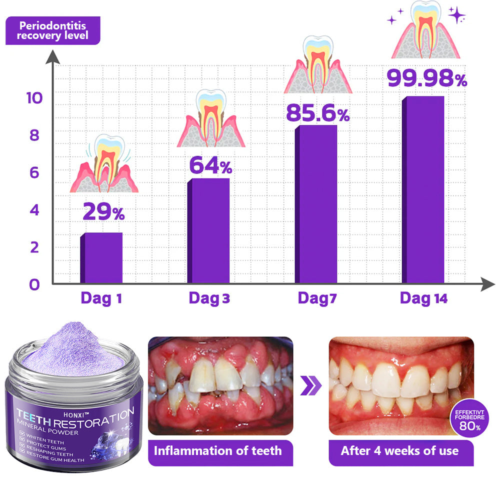 Honxi™ (BDA recommended)TeethRestoration Mineral Powder