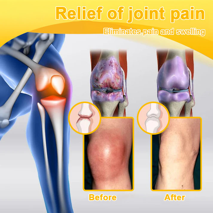 Raindew® Botulinum Toxin & Bee Venom Pain-Relief Bone Healing Cream