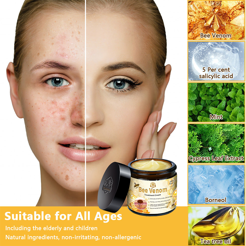 AUS (TGA Recommended, FDA Approved) Turonu Bee Venom Treatment cream (last day promotion 80% off)