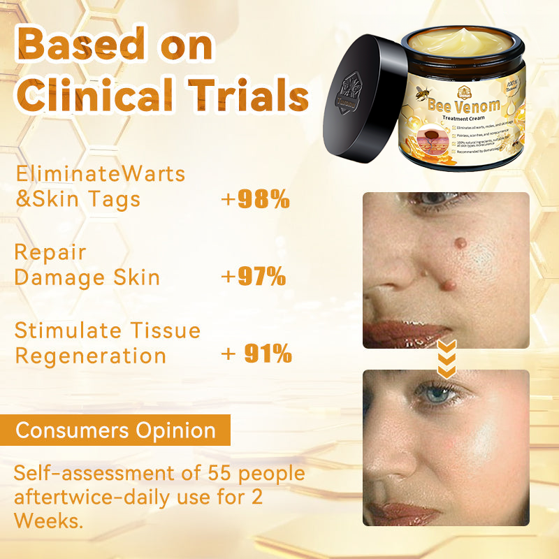 AUS (TGA Recommended, FDA Approved) Turonu Bee Venom Treatment cream (last day promotion 80% off)