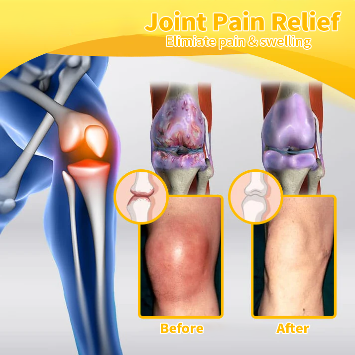 Raindew™ Bee Venom Advanced Joint and Bone Healing Cream (New Zealand Bee Extract - specializing in orthopedic conditions)